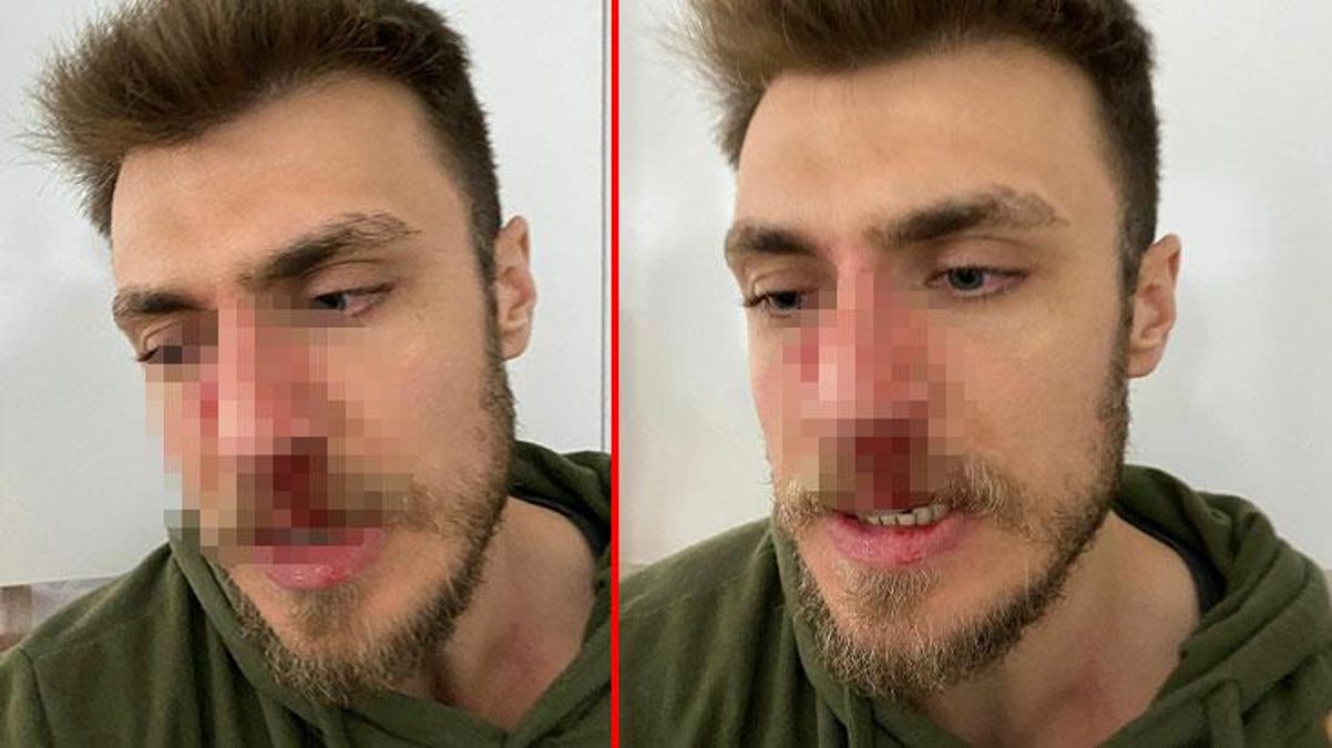 Erkek doğum uzmanını 
